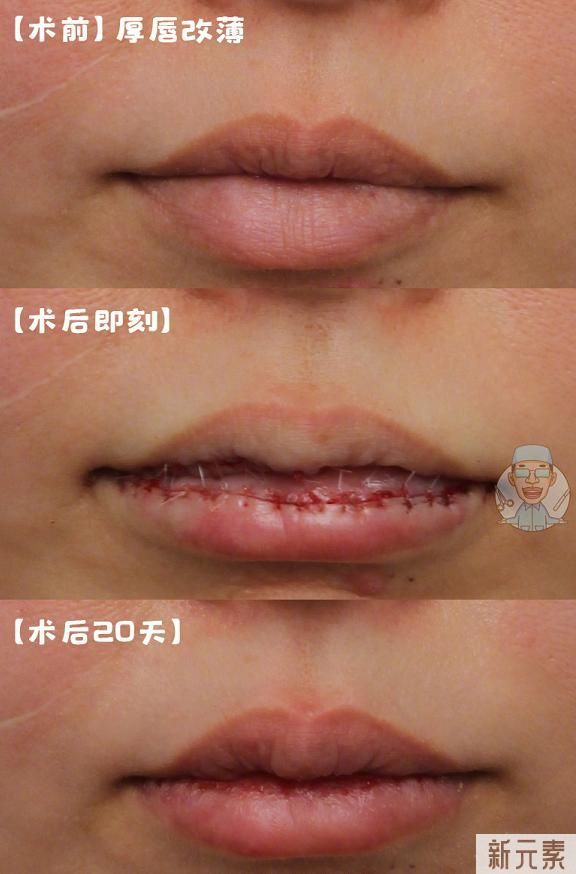 嘴唇厚是一种怎样的体验? 图片-4