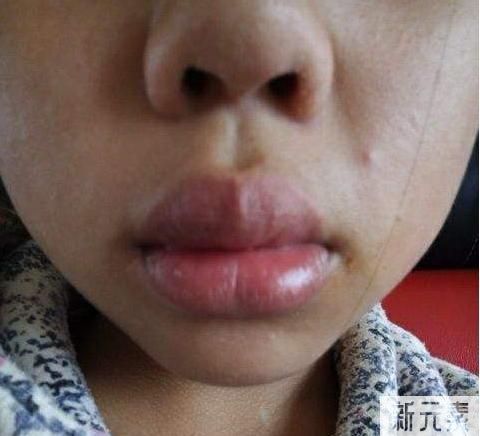 嘴唇厚是一种怎样的体验? 图片-2
