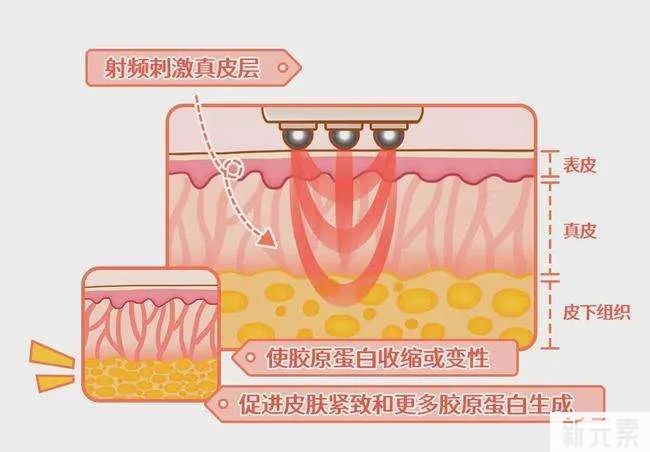 你知道吗?热玛吉还可以做这些部位 图片-31