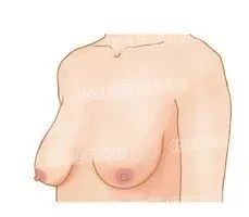 乳房下垂都是因为不穿内衣导致的? 图片-2