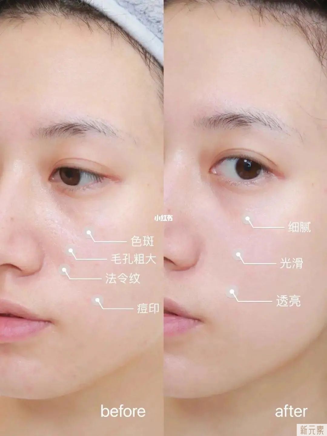 医美科普 