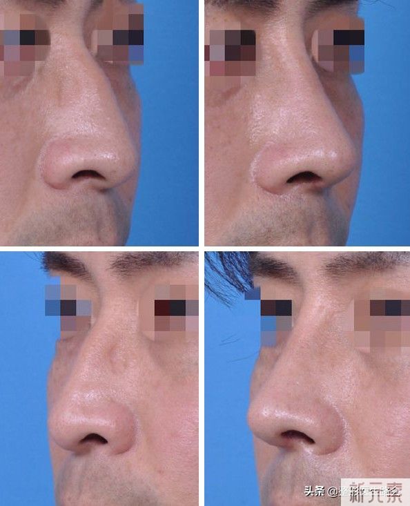 你们对“男性整形”怎么看? 图片-1