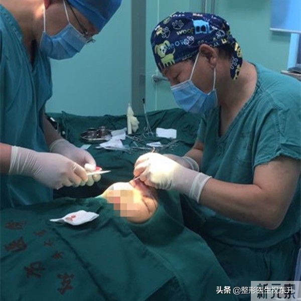 提眉手术,能起到怎样的效果?维持多久? 图片-1