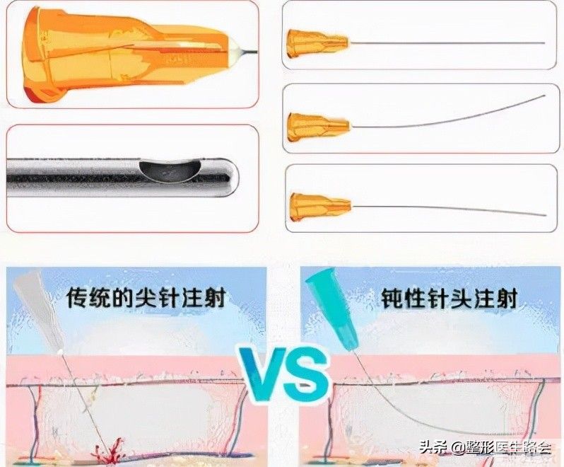 关于玻尿酸隆鼻、填充太阳穴、泪沟,那些医生不会告诉你的 图片-6
