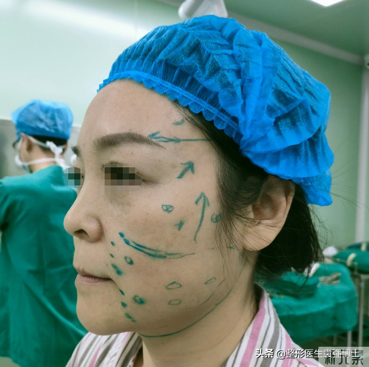40岁后如何避免在医美抗衰项目上“踩雷”,医生总结告诉你 图片-1