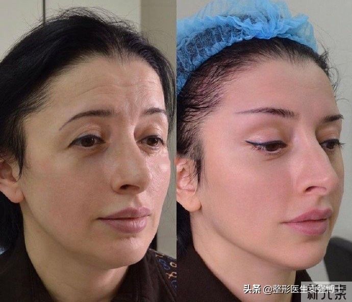 40岁后想年轻,医生给你几点抗衰的建议 图片-1