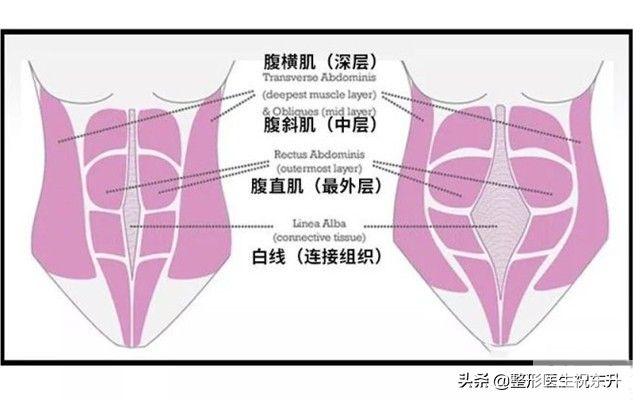 产后腹部松弛,身材走样,还能恢复如初吗? 图片-1