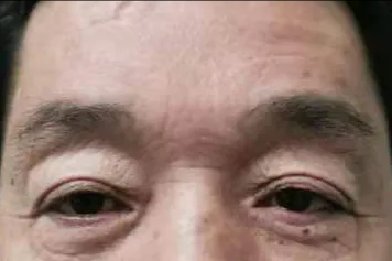 简谈除皱的那些事(一) 图片-4