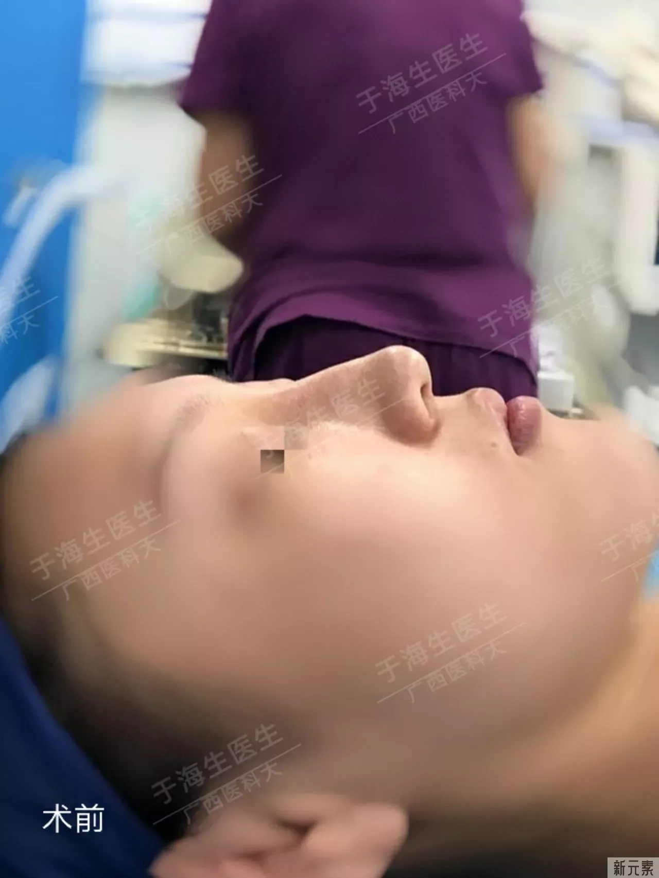 直鼻好还是微翘鼻好?如何区别? 图片-1