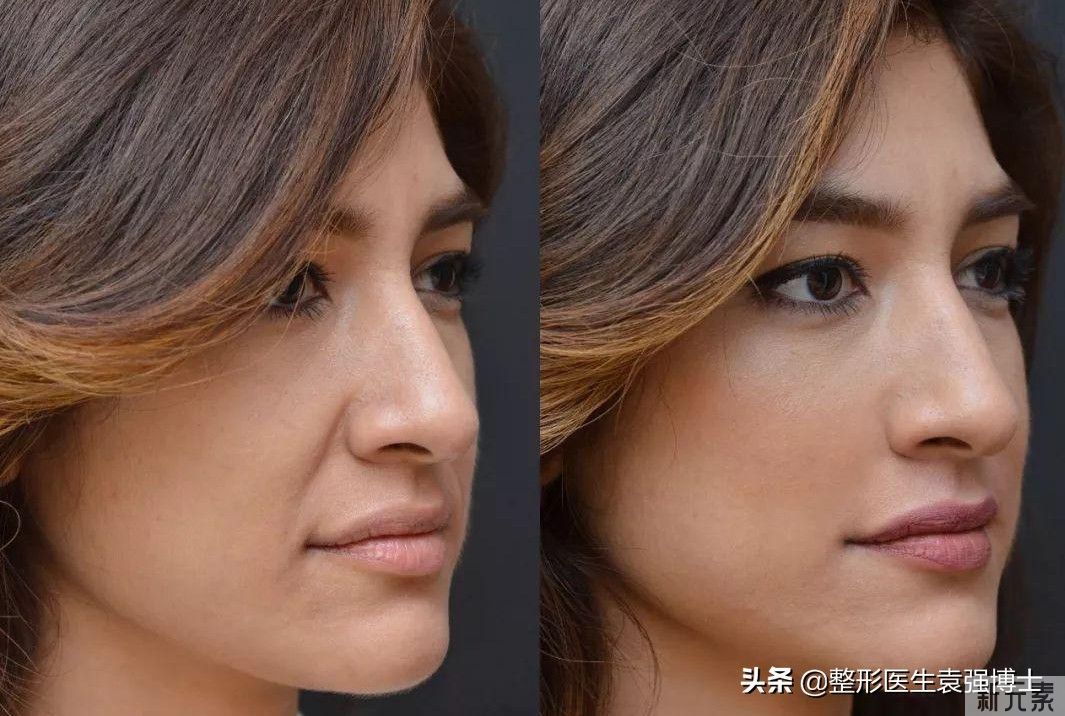 身边女护士们最喜欢的医美项目(大公开) 图片-1