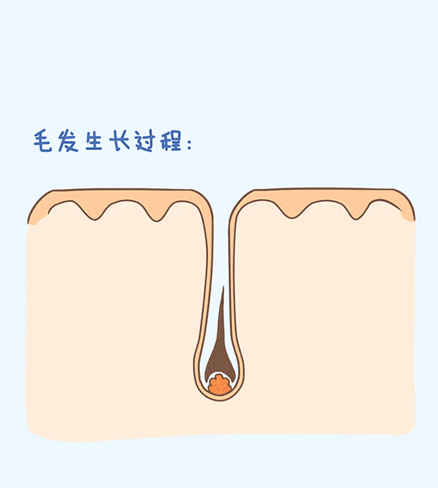 一根不受欢迎的体毛,决定去死,然后...... 图片-3