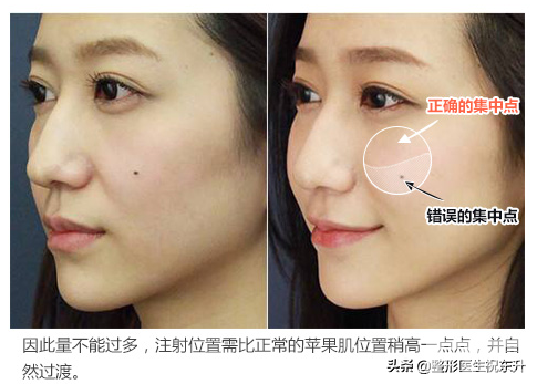好看、饱满的苹果肌,确实是个加分项! 图片-1