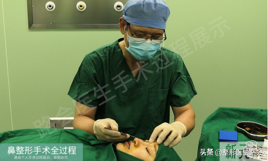 隆鼻手术全过程「真实细节」分享,想要做鼻子的姑娘一定要看看 图片-8