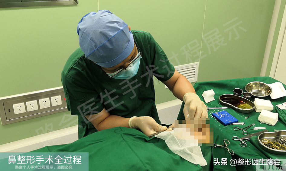 隆鼻手术全过程「真实细节」分享,想要做鼻子的姑娘一定要看看 图片-17