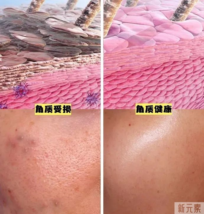爆痘缺水!春日维稳养肤，交给它们! 图片-3