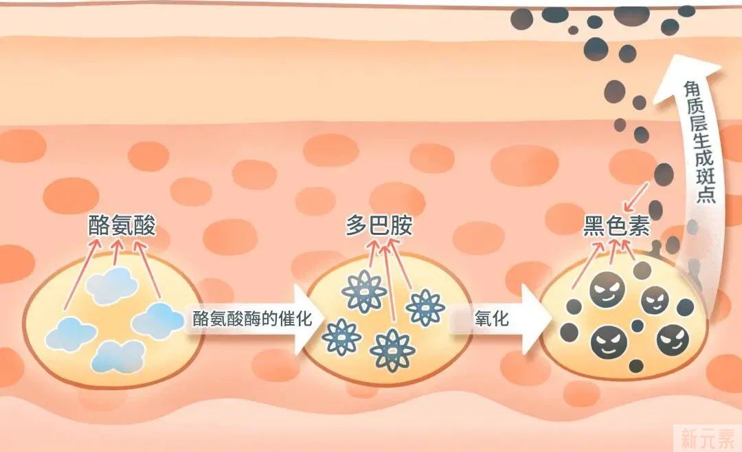 科学来看，斑有多影响颜值?!请启动您的“祛斑”计划! 图片-14