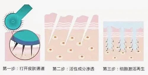怎样改善改善眼周衰老? 图片-5
