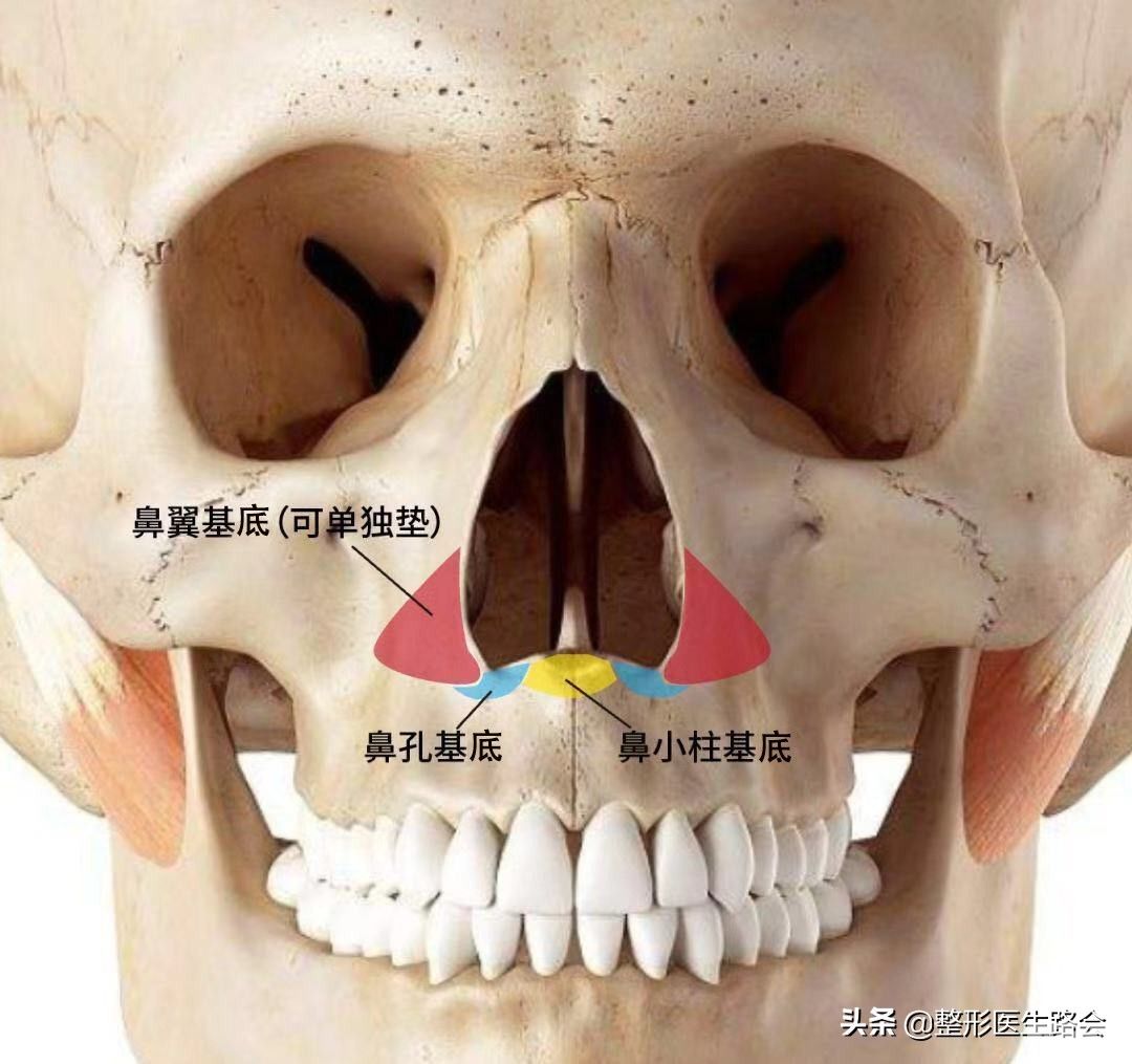40+、50+法令纹明显，是做“面部提升”?还是“鼻基底填充”? 图片-3