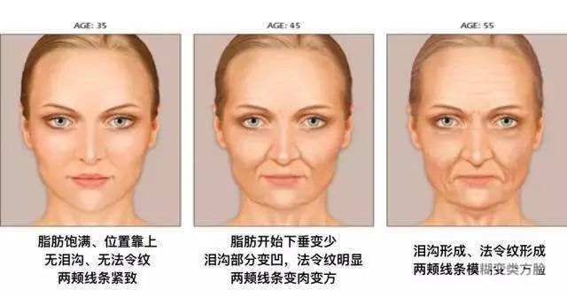 如何精准改善法令纹? 图片-6