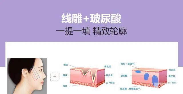 如何精准改善法令纹? 图片-10