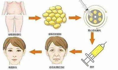 如何改善面部凹陷? 图片-4