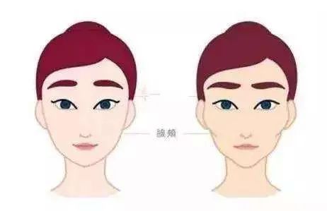 如何改善面部凹陷? 图片-2