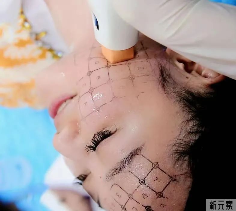 热玛吉痛吗?大量样本调研结果告诉你! 图片-11