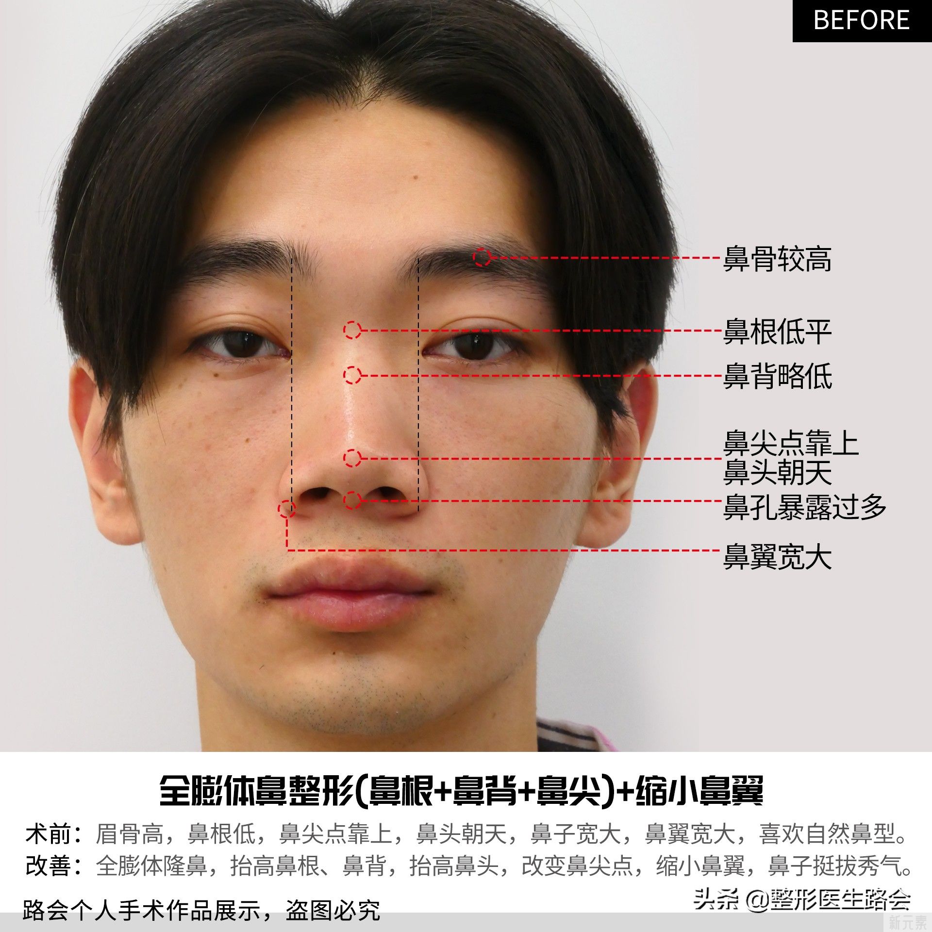 为什么说:对于男性求美者的筛选要比女性更 图片-1