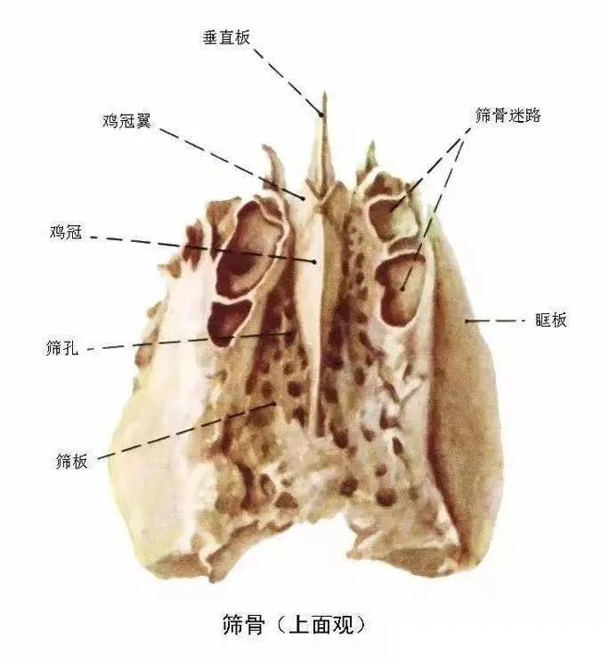 筛骨垂直板在唇裂鼻畸形修复中的应用 图片-2