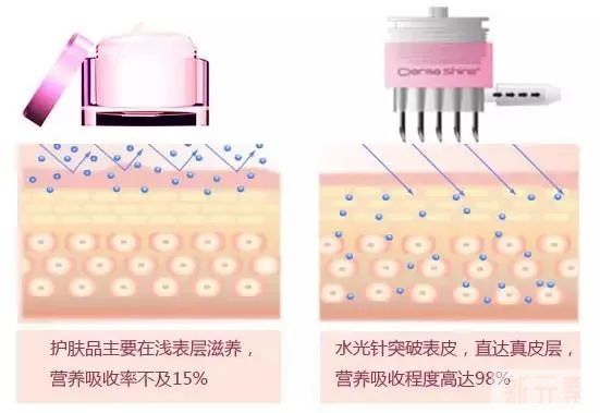 易衰老型肤质有哪几种? 图片-5
