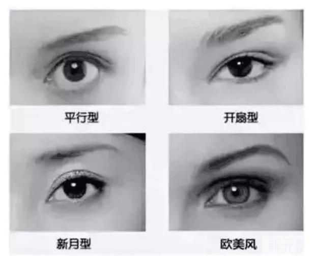 都是割双眼皮，为什么你的看起来假? 图片-2