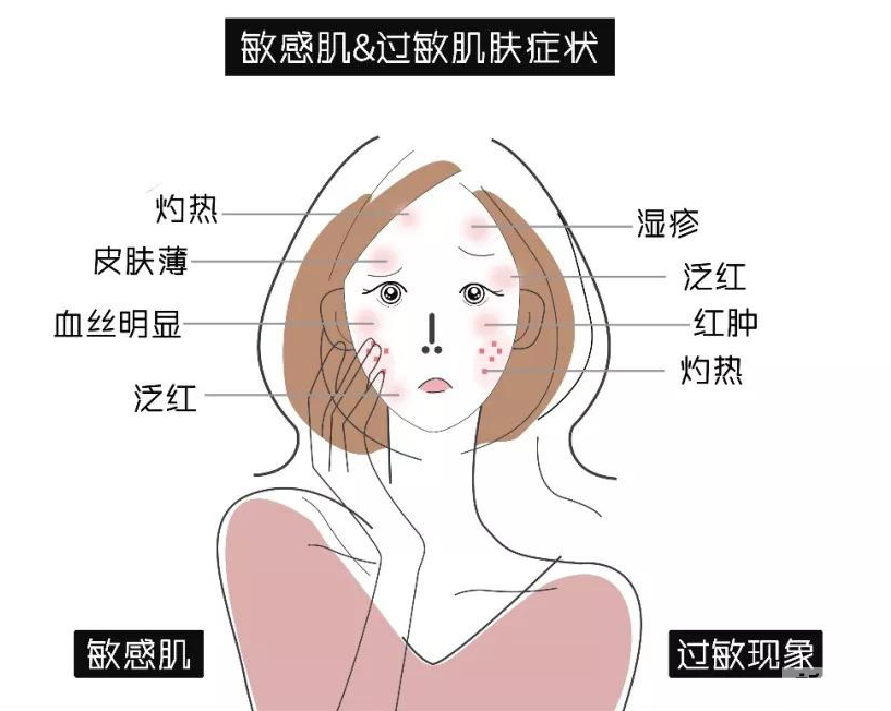 爆痘、粗糙、红、痒....你皮肤屏障受损了! 图片-3