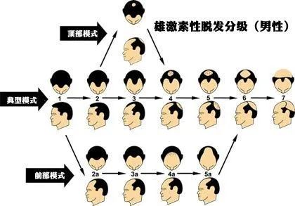 脱发很可怕，了解非那雄胺后也不是那么可怕! 图片-9