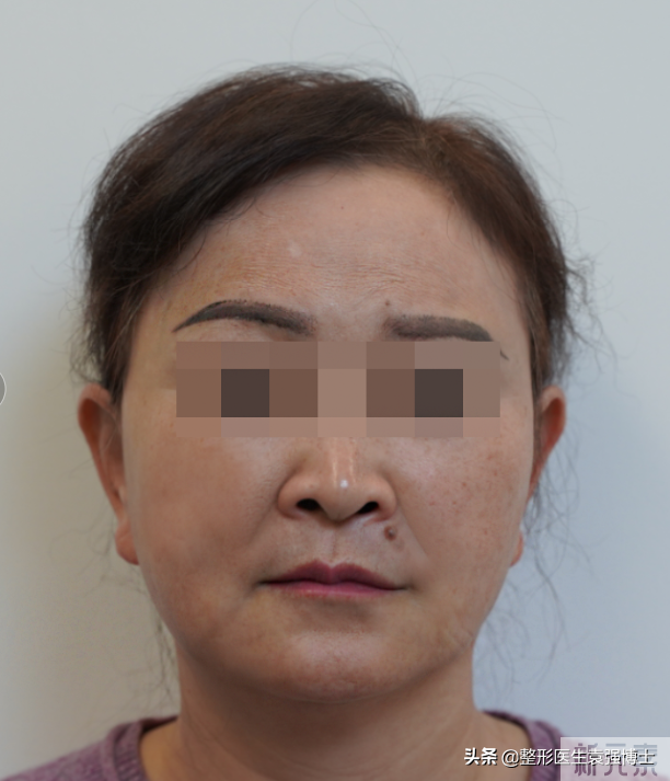 60岁从重庆来北京做大拉皮，我来给大家分享一下我的经历 图片-1