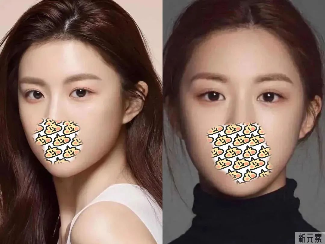 韩国“江南美人”保质期仅一年?轮廓手术后遗症也太吓人了... 图片-3