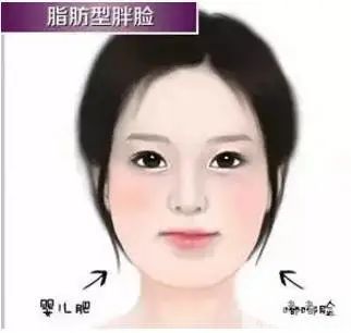 韩国“江南美人”保质期仅一年?轮廓手术后遗症也太吓人了... 图片-8