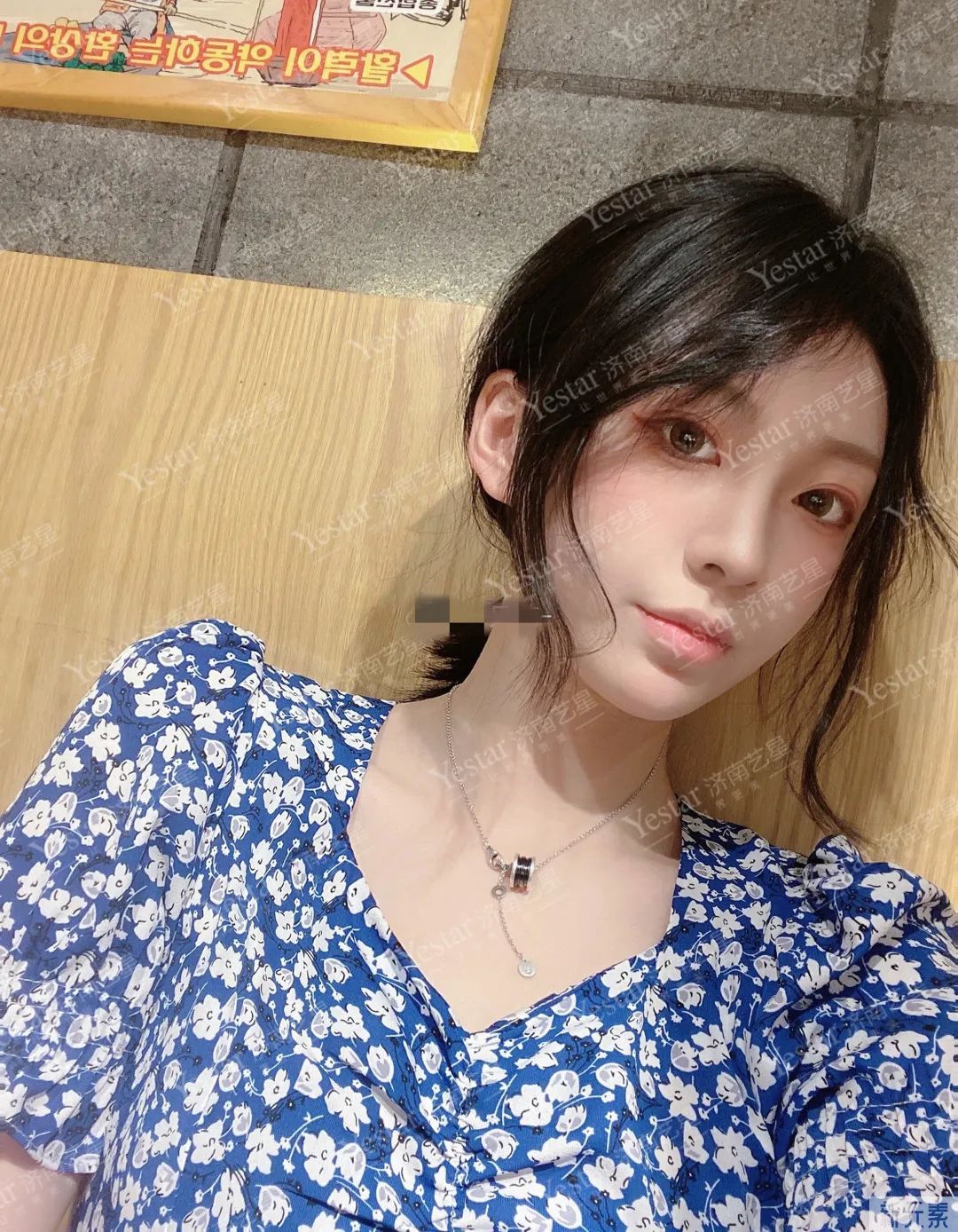 韩国“江南美人”保质期仅一年?轮廓手术后遗症也太吓人了... 图片-12