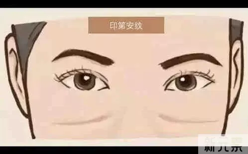 ❓不会吧?!做了眼袋手术，怎么长出了印第 图片-1