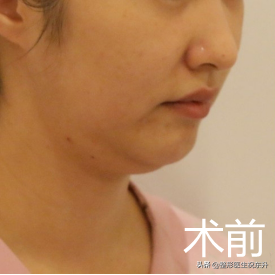 清晰的下颌线和毫无赘肉的下巴，是一个人面 图片-1
