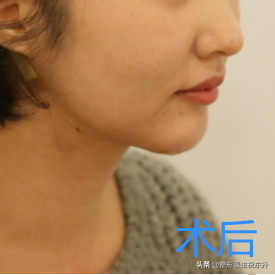 清晰的下颌线和毫无赘肉的下巴，是一个人面 图片-2