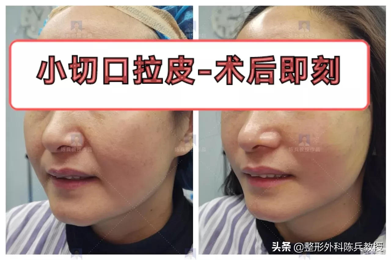 【42岁为什么老得这么快?心里接受不了怎 图片-2