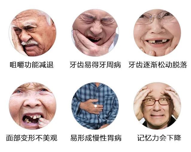 种植牙可怕吗?医生:比拔智齿还轻松! 图片-3