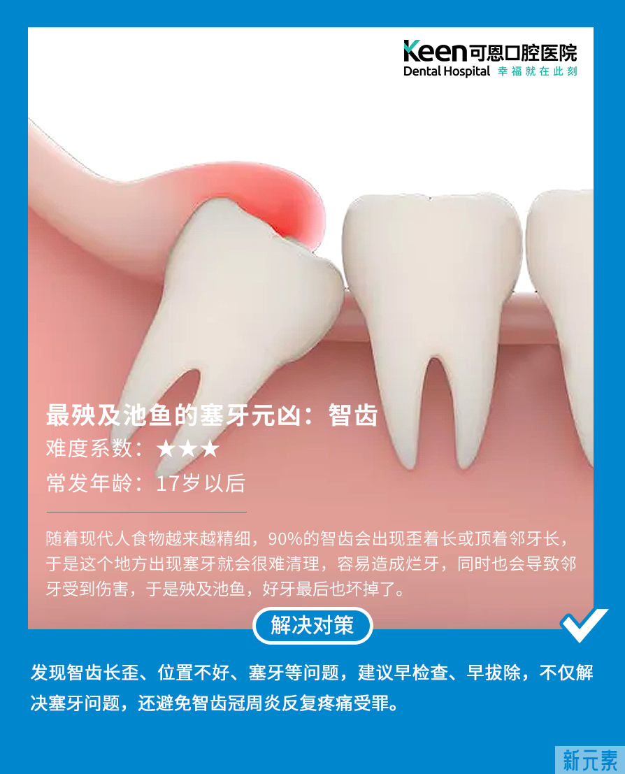 你为什么总塞牙?4个原因告诉你! 图片-4