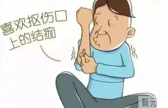 ​受伤后，认真做好这5点，避免色素沉着 图片-8