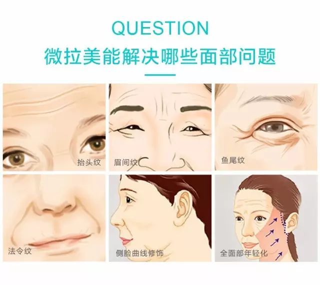 微微一拉很倾城，岁月从不败美人 图片-6