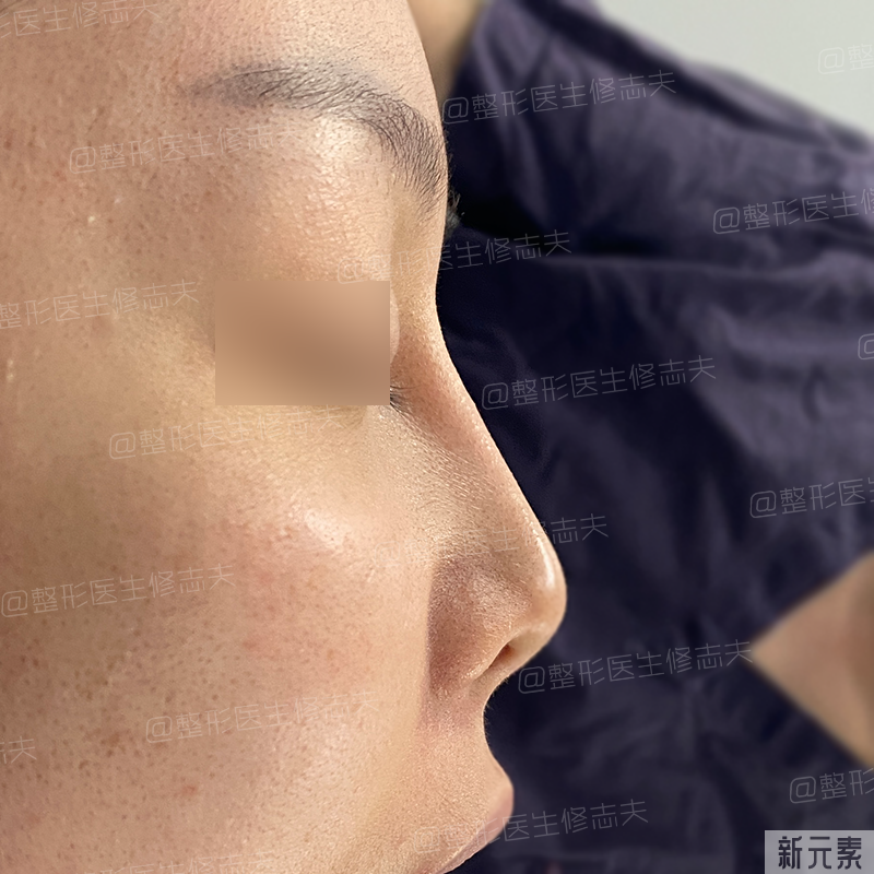 这就是所谓“年抛鼻”?更离奇的事出现了... 图片-3