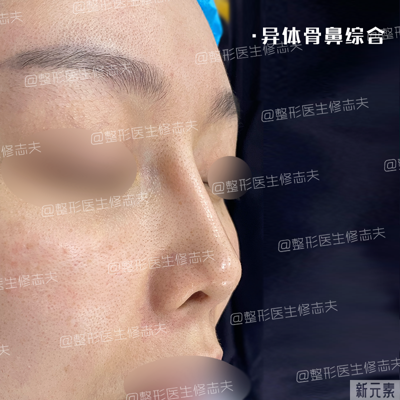 这就是所谓“年抛鼻”?更离奇的事出现了... 图片-9