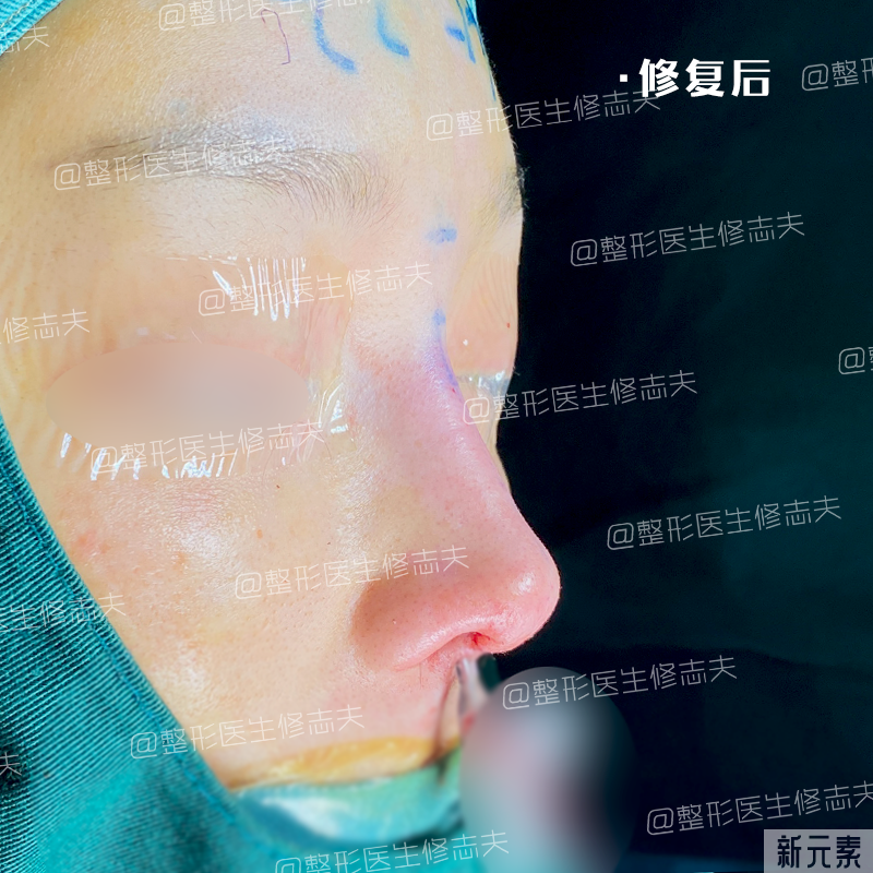 这就是所谓“年抛鼻”?更离奇的事出现了... 图片-10