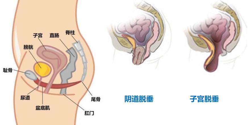 这部分肌肉群所有女人都要运动下! 图片-10