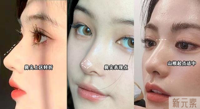 「网红鼻」已经过时，「妈生鼻」审美开始觉醒! 图片-15